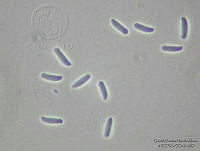 GPHA0079 Gyrothrix microsperma.jpg