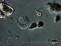EDISyBDP024 Prorocentrum emarginatum.jpg