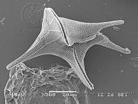 ZME y MEMC-LFMS262 Protoperidinium elegans.JPG