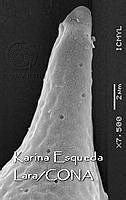 KEL0291 Phalacroma oxytoxoides.JPG
