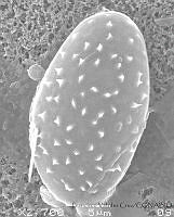 FVC0035 Chaetoceros sp.jpg