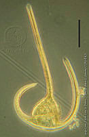 DJ017-15 Ceratium arietinum gracilientum.jpg