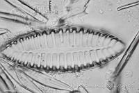 KT018 0255 Surirella biforns.jpg