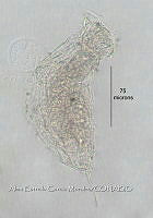 HE009 R 0131 Trichocerca stylata.jpg