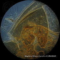 MVG 0650 Uroobovella sp..JPG
