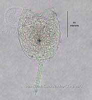 HE009 R 0134 Lecane lunaris.jpg