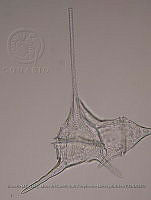 ZME y MEMC-LFMS299 Ceratium balechii f. longum.JPG