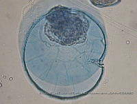 ZME y MEMC-LFMS291 Pyrophacus steinni ssp. vancompaoe.JPG