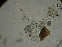 JSP060 Ceratium lineatum.JPG