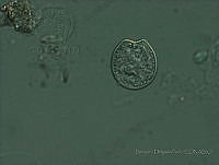 BDP0157 Prorocentrum emarginatum.jpg