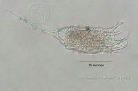HE009 R 0135 Keratella americana.jpg