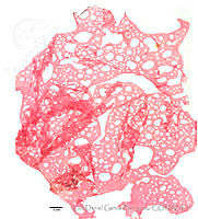 LDGR025 Kallymenia pertusa.jpg
