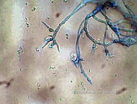 ME008 0011 Acremonium.jpg