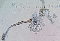 ME008 0064 Aspergillus.jpg