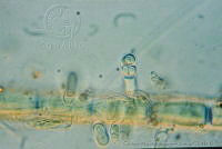 UNAMGAMZ-8 Chamaecalyx calyculatus.jpg