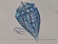 ZME y MEMC-LFMS295 Corythodinium tesselatum.JPG