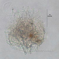 HE009 R 0095 Brachionus quadridentatus.jpg