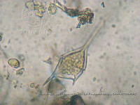 ZME y MEMC-LFMS290 Ceratium minutum.JPG
