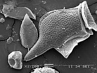 ZME y MEMC-LFMS275 Dinophysis caudata.JPG