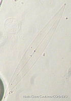 NCC0071 Pleurosigma directum.JPG