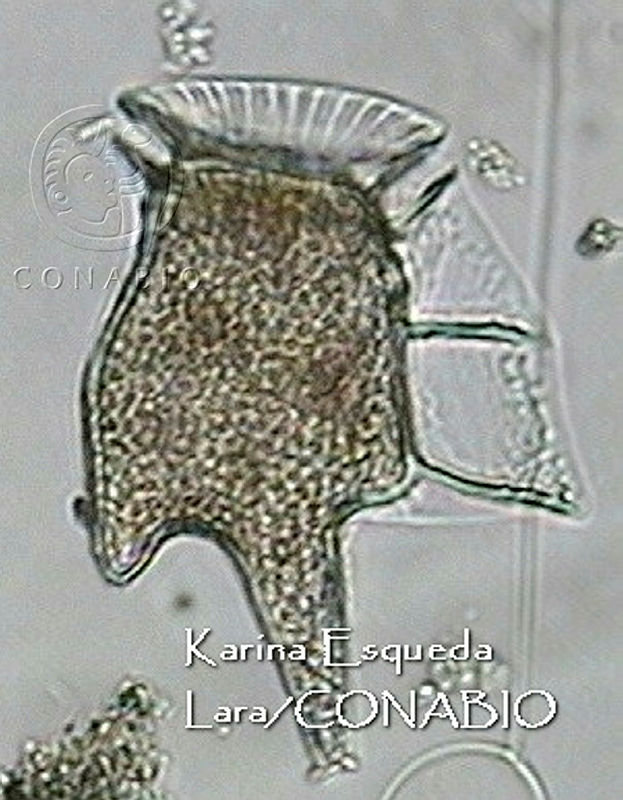 KEL0134%20Dinophysis%20tripos.JPG.jCeuwIn0ManLt4NhQA3g0JtbmFja29CbnFuZ3NAbXJ6LGtwZwA. p7TYtautz