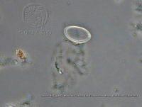 ZME y MEMC-LFMS293 Cocconeis scutellum.JPG