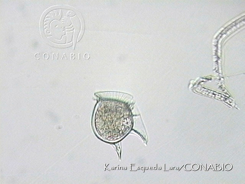 KEL0117%20Dinophysis%20phalacromoides.JPG.jCeA Ir0MeVfue9fQA3g0JtbmFja29CbnFuZ3NAbXJ6LGtwZwA.L9C25netyV