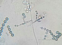 ME008 0356 Scopulariopsis spp..jpg