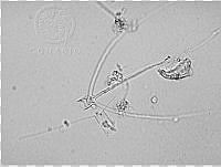 DUHB0070 Chaetoceros compressus.png
