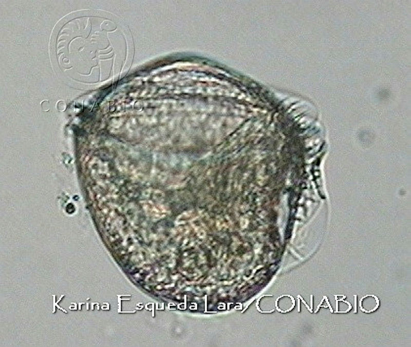 KEL0081%20Dinophysis%20apicata.JPG.jCeN9Yn0MUkvuYNhQA3g0JtbmFja29CbnFuZ3NAbXJ6LGtwZwA.J50OQkVkJk