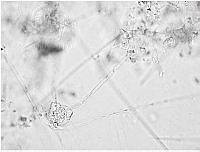 DUHB0096 Chaetoceros peruvianus.JPG