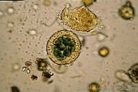 UNAMGAMZ-1 Asterocapsa divina.jpg