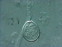 BDP0163 Prorocentrum hoffmannianum.jpg