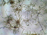 ME008 0116 Cladosporium.jpg