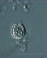 BDP0168 Prorocentrum emarginatum.jpg