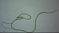EAMS010 Litomosoides sp..jpg