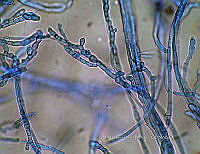 ME008 0208 Monilia.jpg