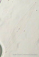 NCC0071 Pleurosigma directum.JPG