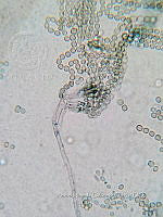 ME008 0288 Penicillium.jpg