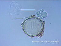 JF068 0761 Diversispora spurca.jpg